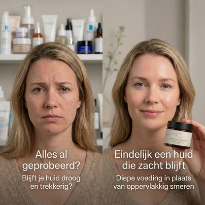 Honey & Tallow - Crème (Acne)